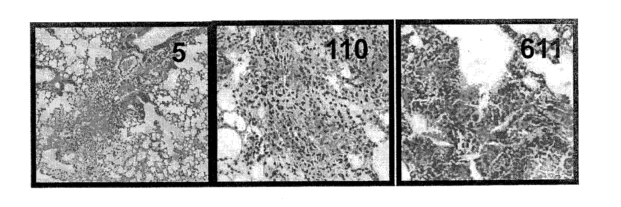 Antibody Specific to the AIMP2-DX2