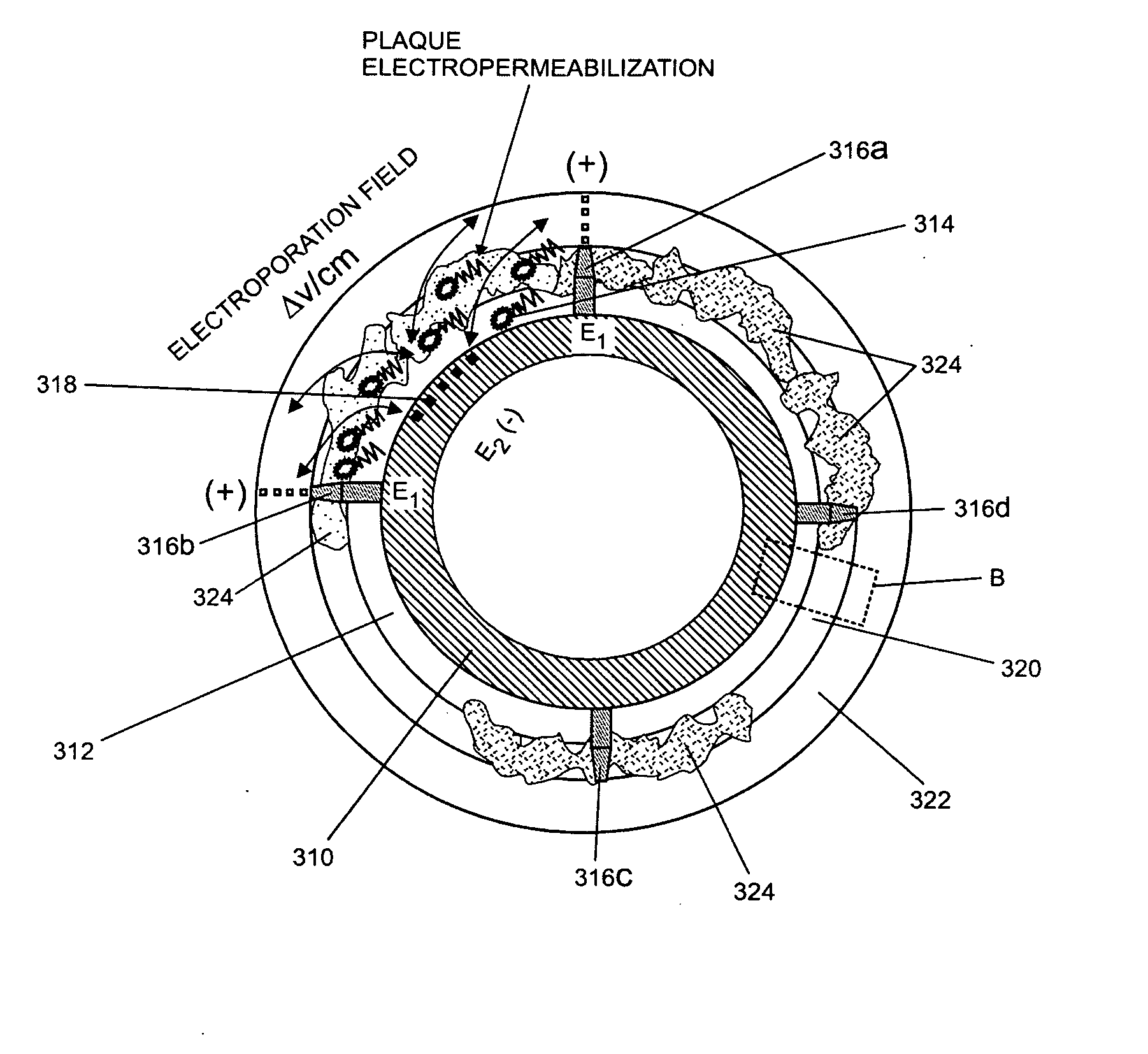 Internal medical devices for delivery of therapeutic agent in conjunction with a source of electrical power