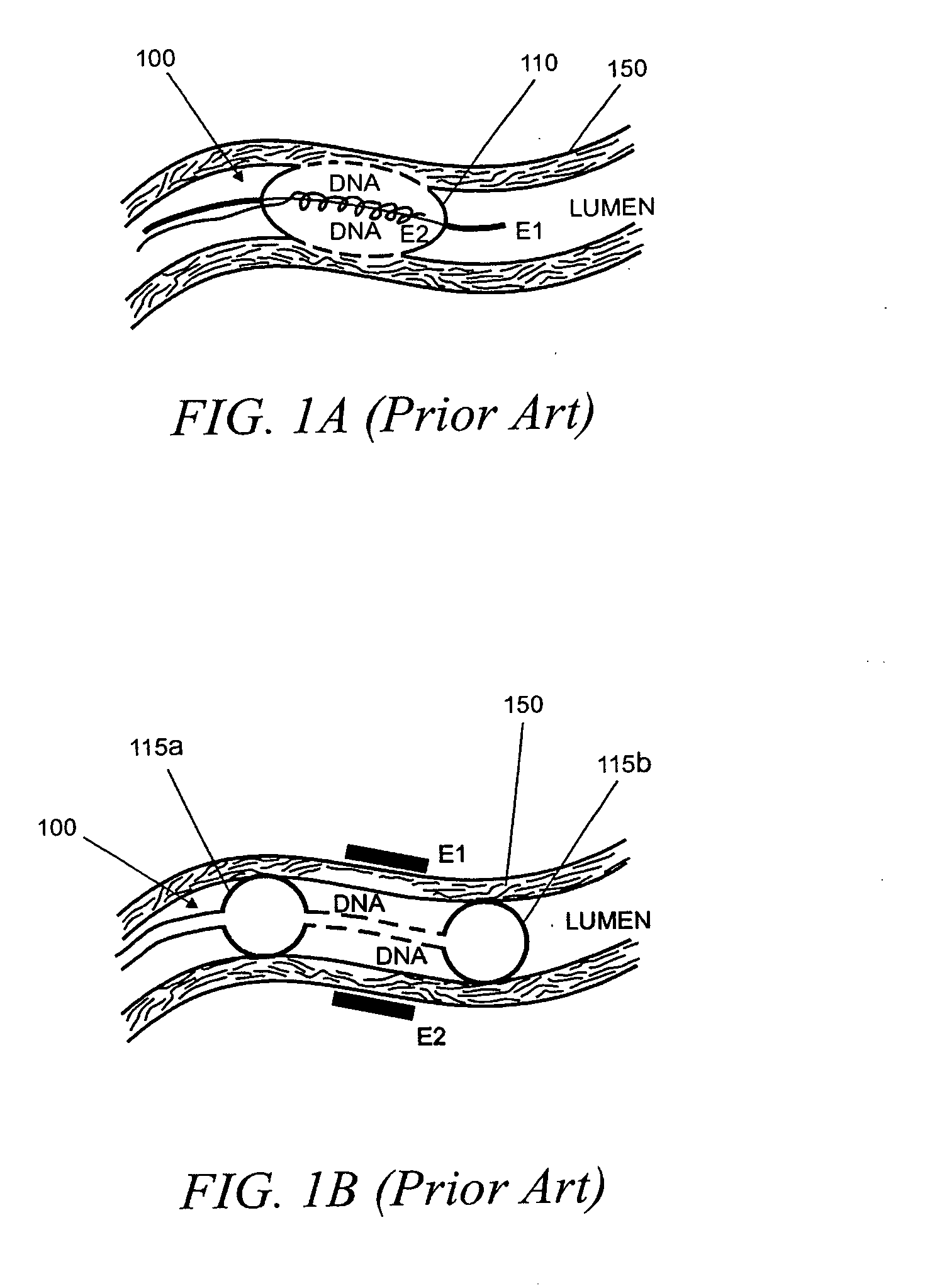 Internal medical devices for delivery of therapeutic agent in conjunction with a source of electrical power