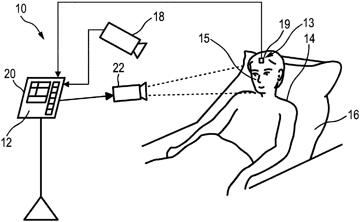 Device, system and method for monitoring of peripheral arterial perfusion of a subject