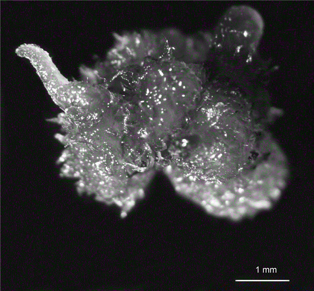 Green globular body tissue culture propagation method for Alsophila costularis