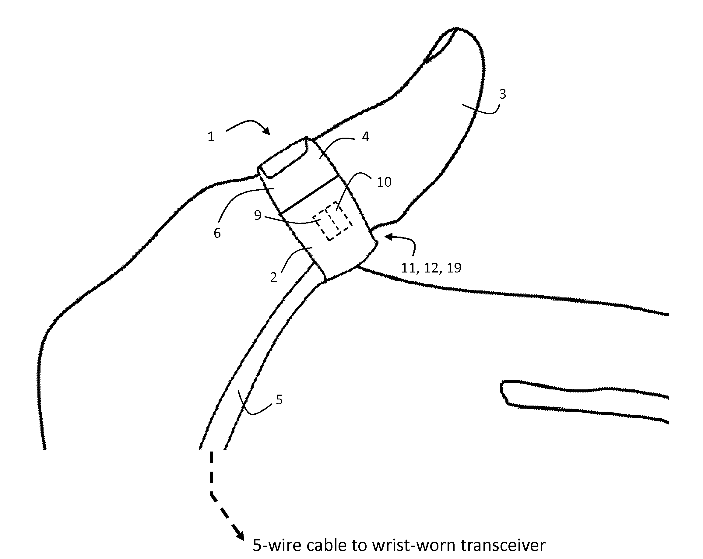 Body-worn pulse oximeter