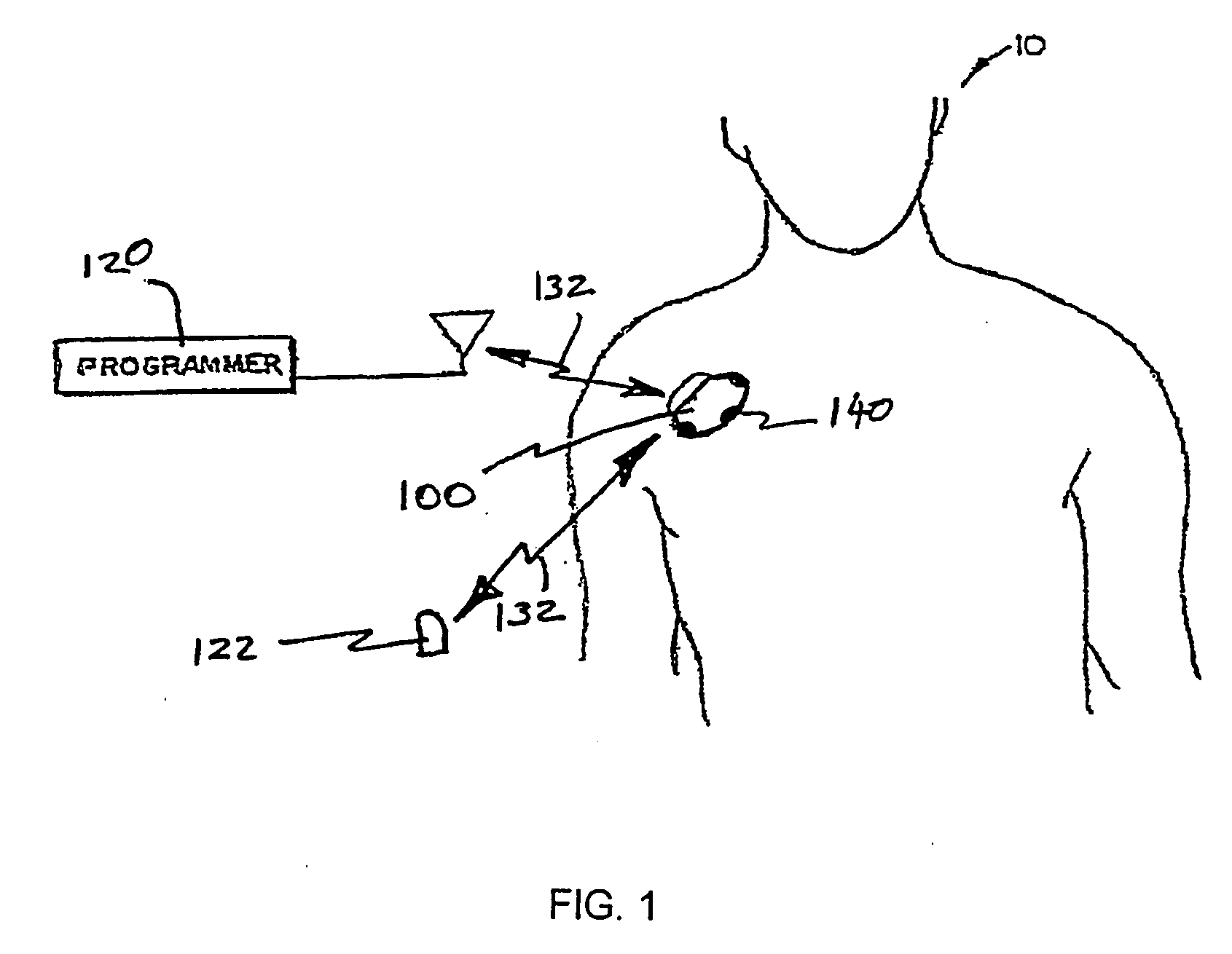 Techniques for data reporting in an implantable medical device