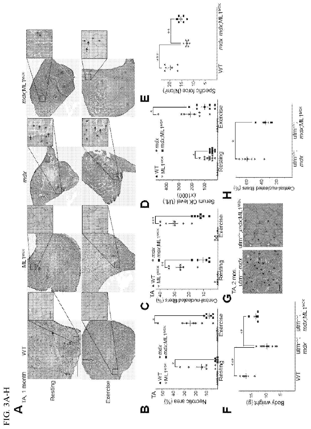 Small molecule agonists of mucolipin 1 and uses thereof