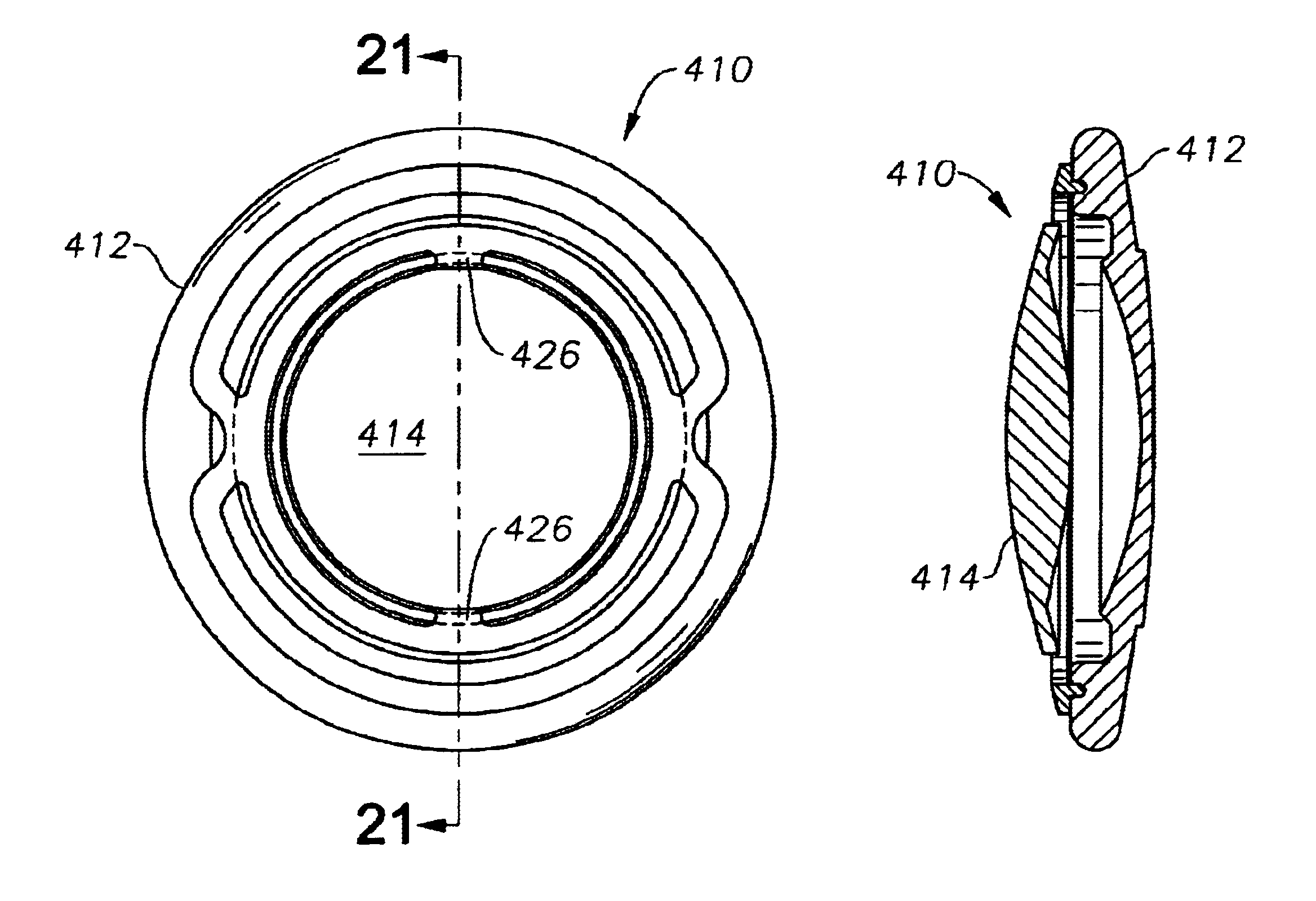 Accommodative intraocular lens