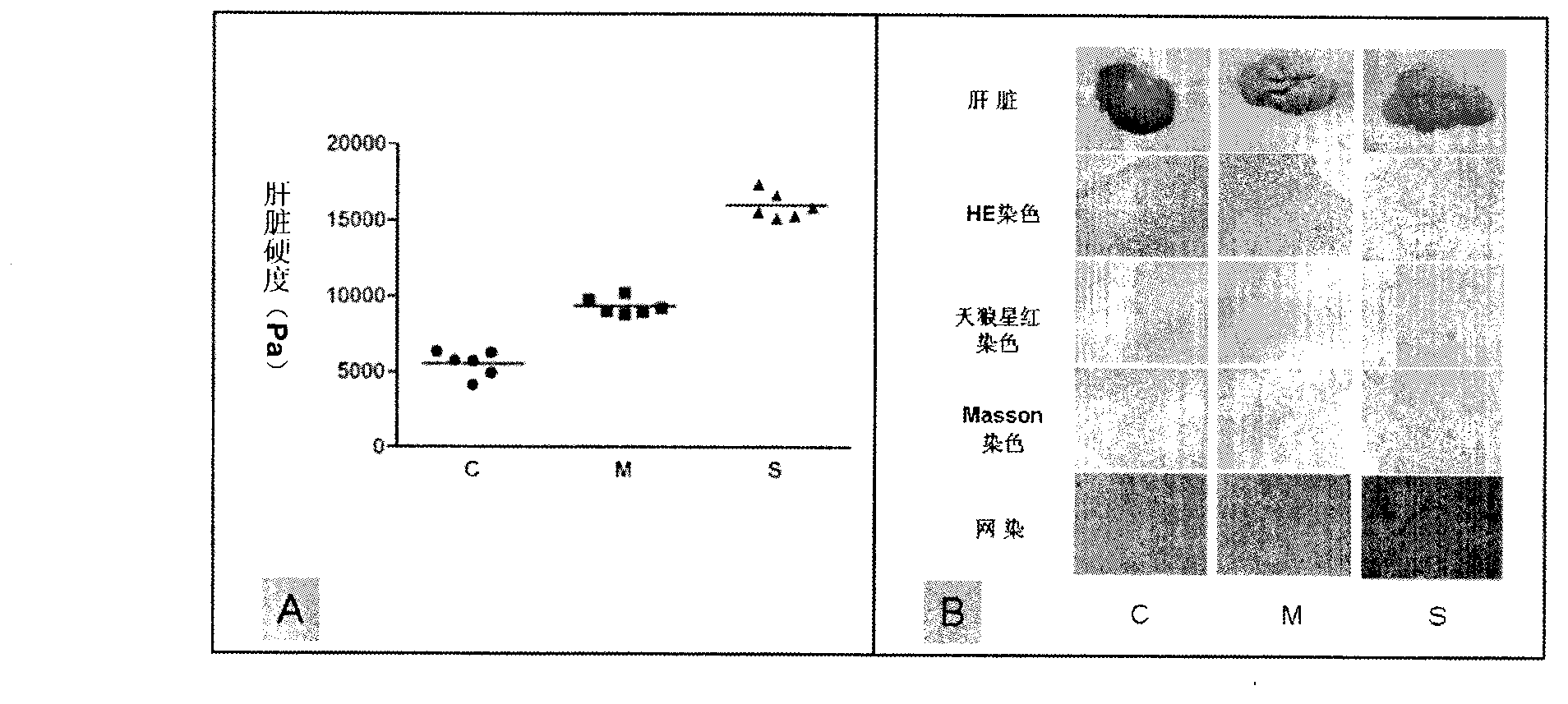 Rat liver cancer model with different liver matrix hardness backgrounds and preparation method of rat liver cancer model