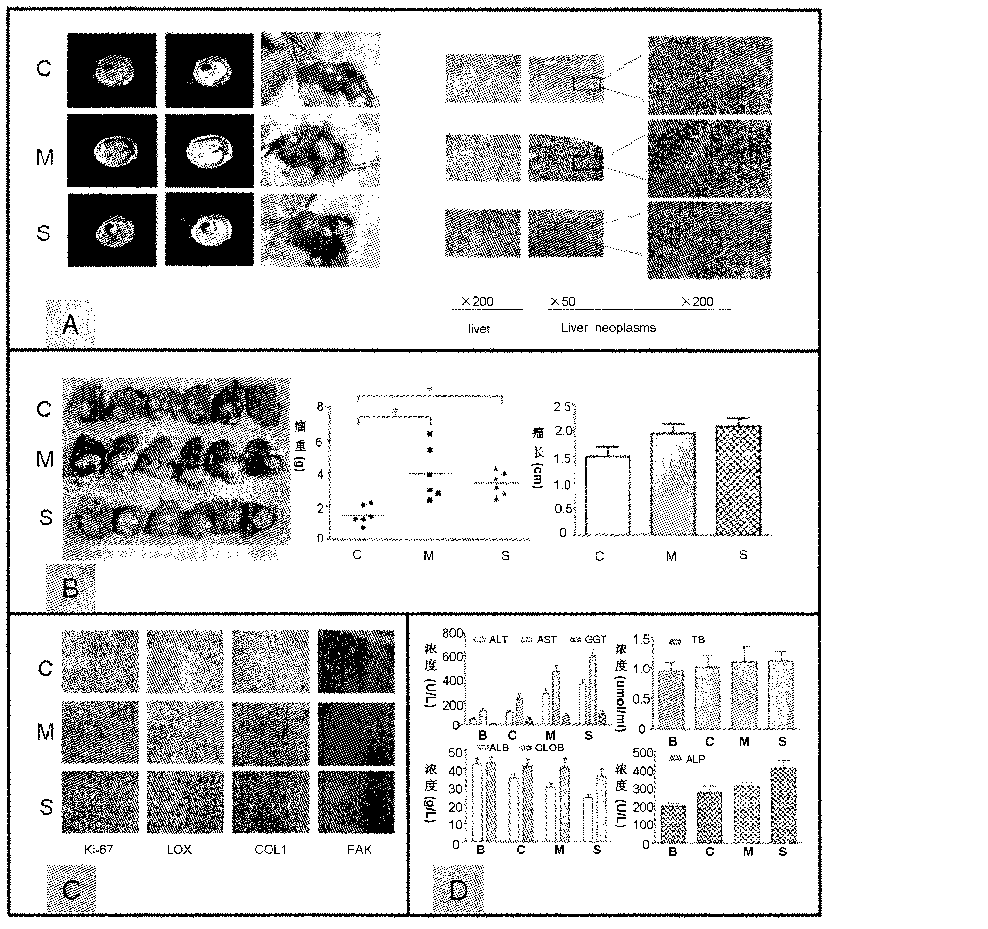 Rat liver cancer model with different liver matrix hardness backgrounds and preparation method of rat liver cancer model