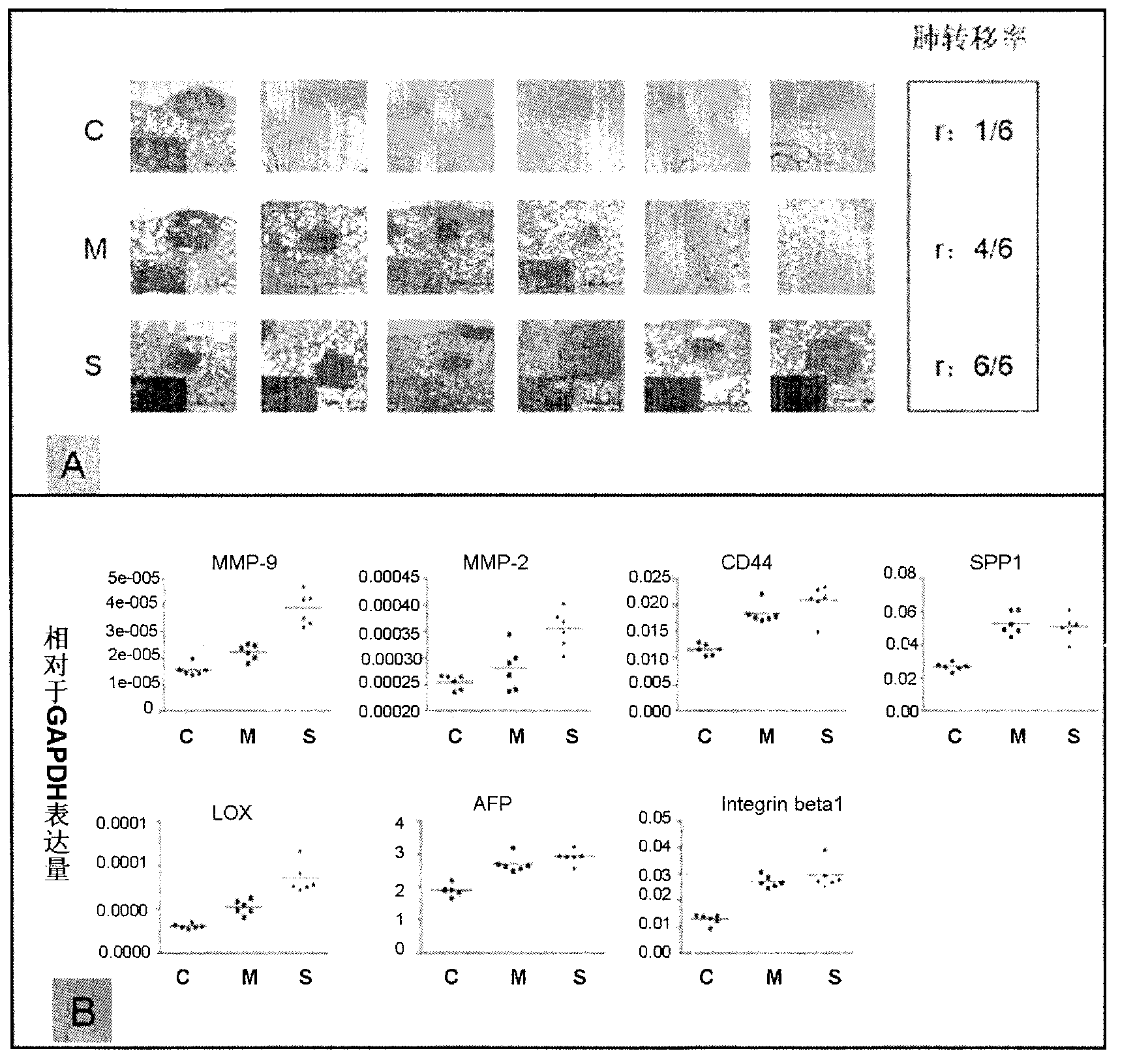 Rat liver cancer model with different liver matrix hardness backgrounds and preparation method of rat liver cancer model