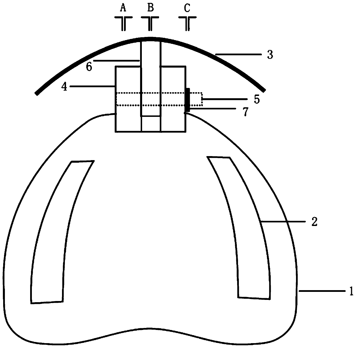 Edentulous jaw individual tray device with front teeth aesthetic considerations