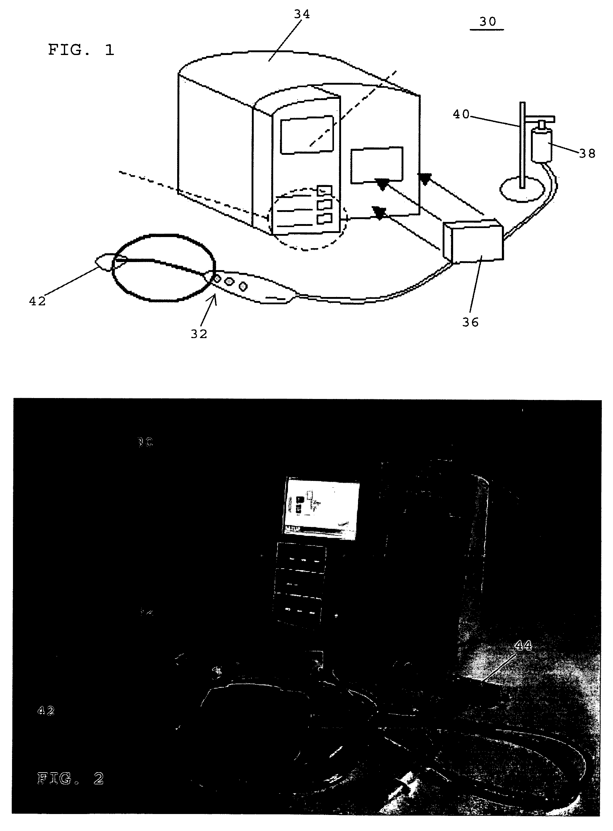 Balloon catheter systems for treating uterine disorders having fluid line de-gassing assemblies and methods therefor