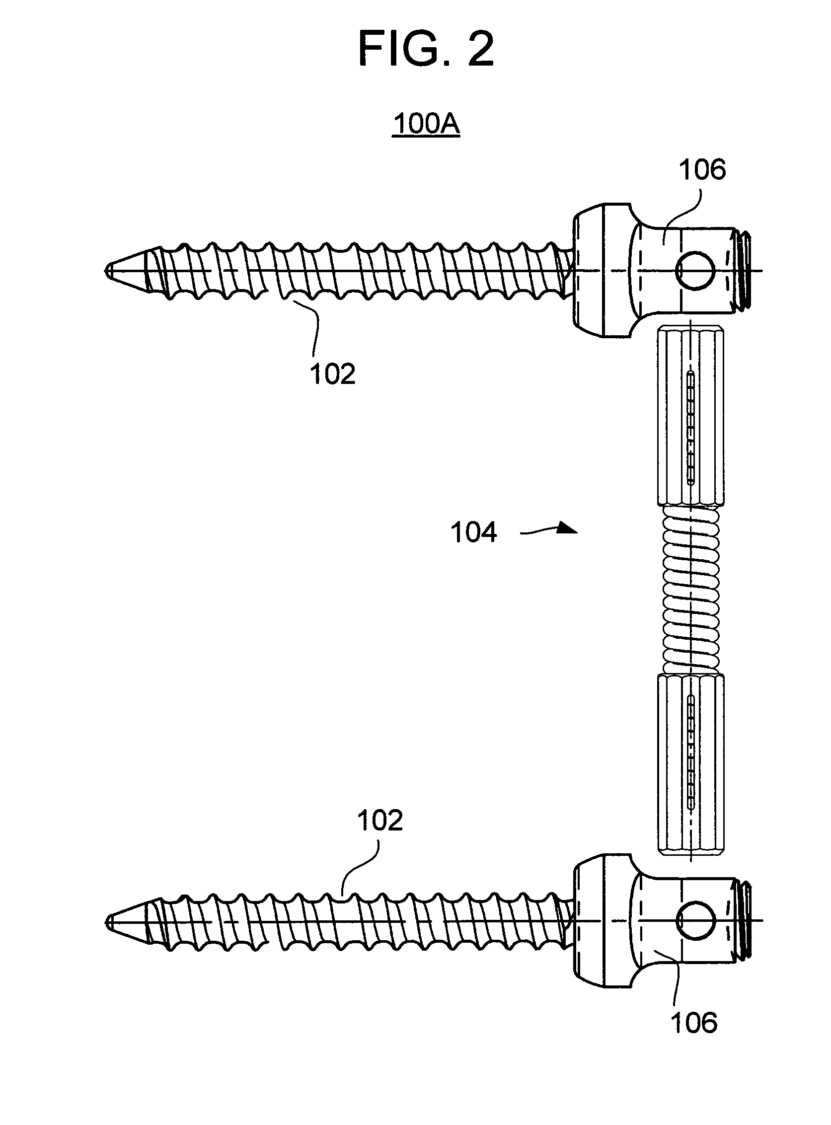 Methods and apparatus for vertebral stabilization using sleeved springs