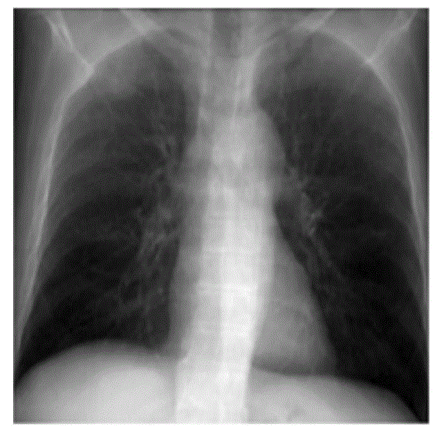 Method for generating dual-energy x-ray ct images from single-source single-scan x-ray ct images