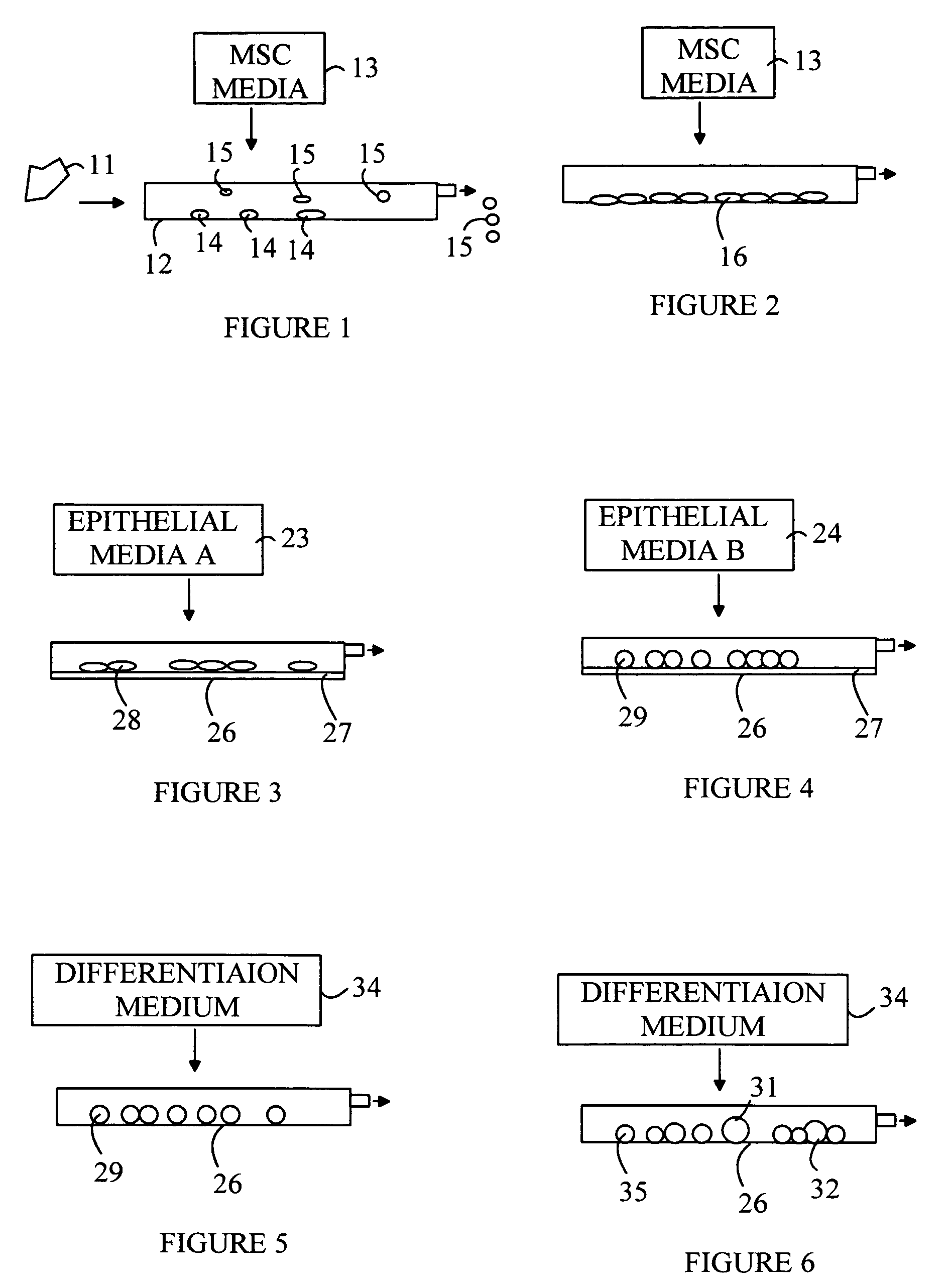 Isolation and purification of human insulin producing cells for the treatment of insulin dependent diabetes