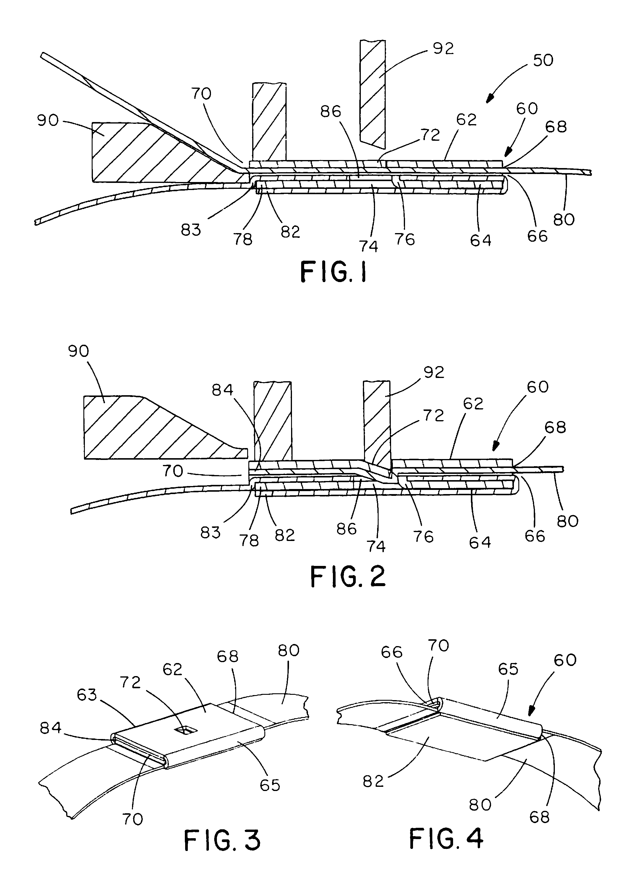 Displacement lock MLT