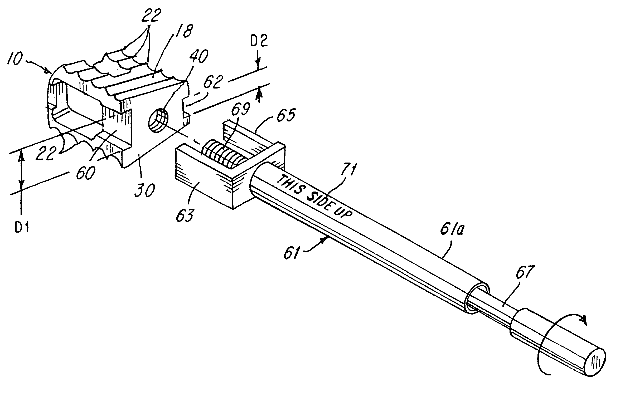 Prosthetic implant with biplanar angulation and compound angles