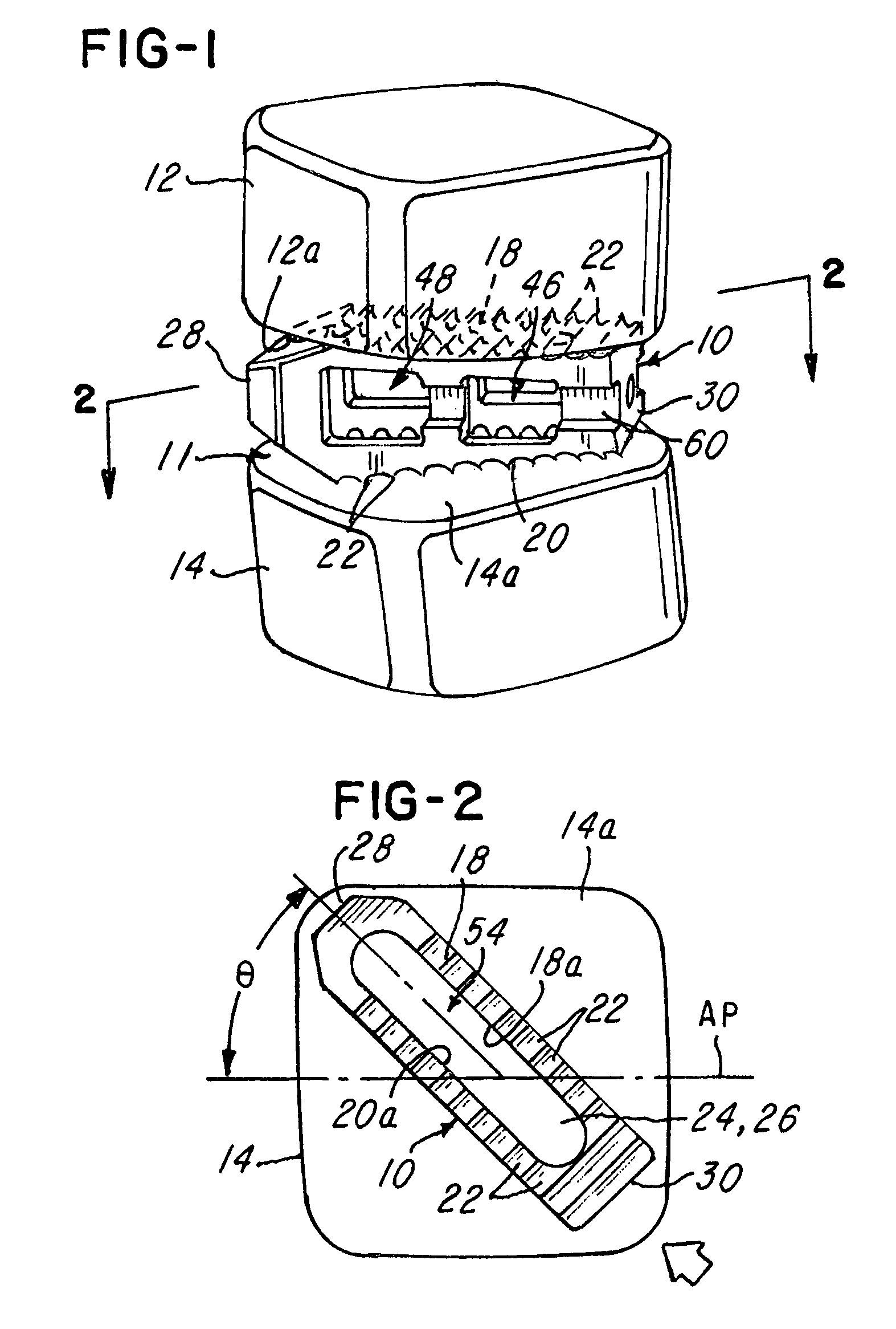 Prosthetic implant with biplanar angulation and compound angles