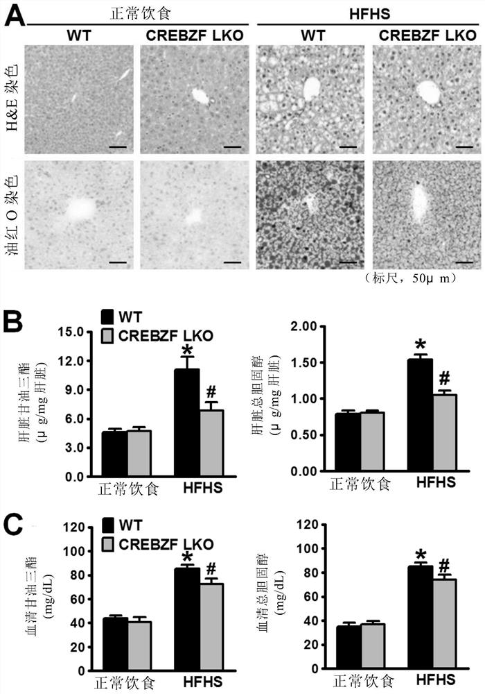 Application of crebzf in the treatment, prevention and diagnosis of metabolic diseases