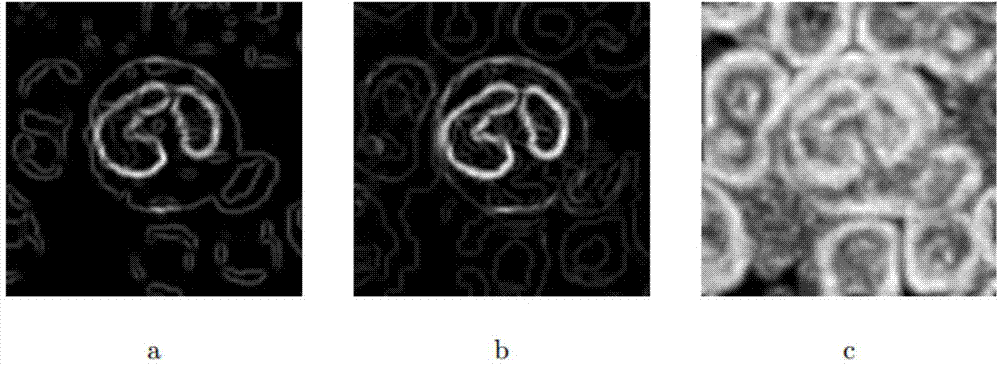 White cell segmentation method based on multi-feature nonlinear combination