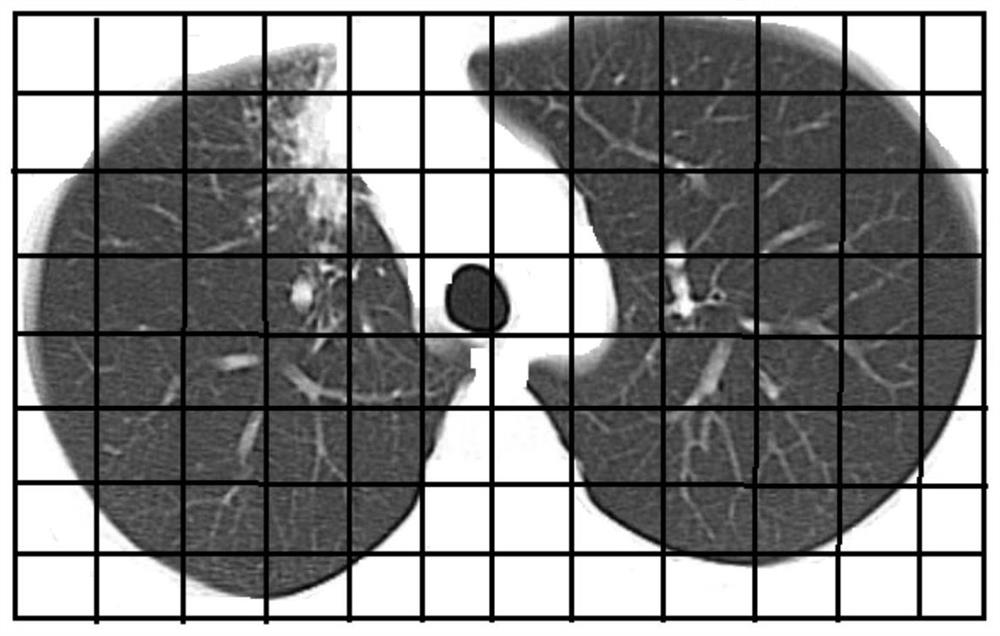 Focus lung segment position identification method and device, storage medium and electronic equipment