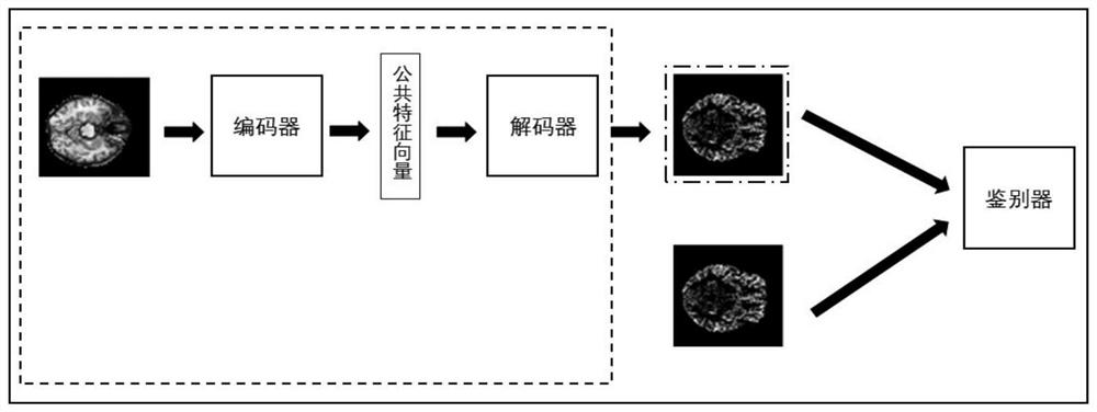 Arterial spin labeling image synthesis method based on generative adversarial hybrid model network