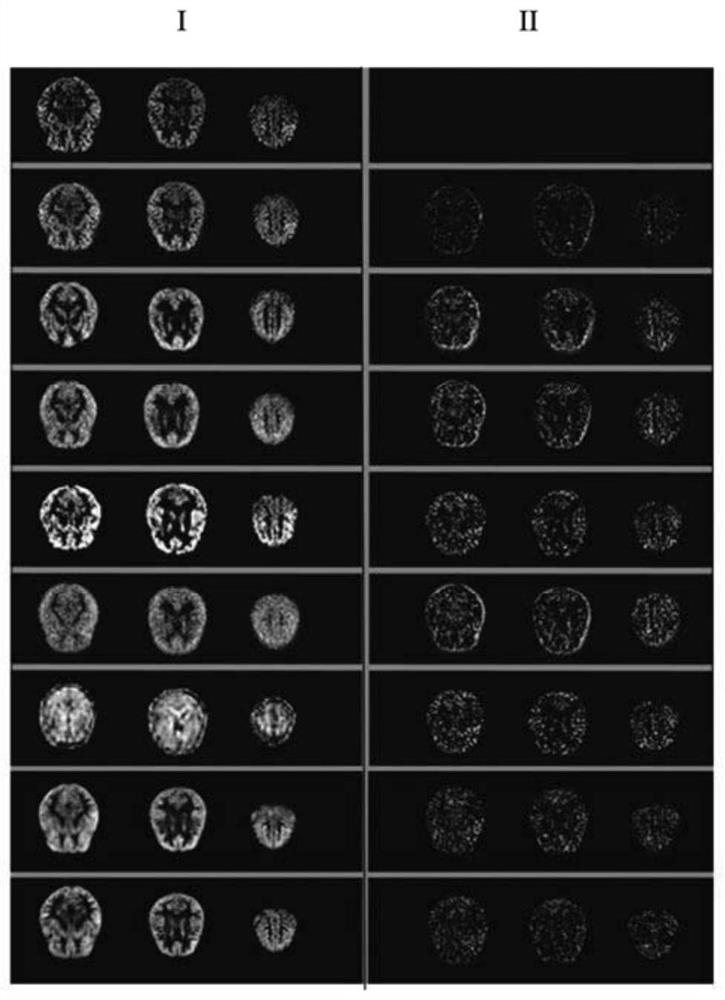 Arterial spin labeling image synthesis method based on generative adversarial hybrid model network