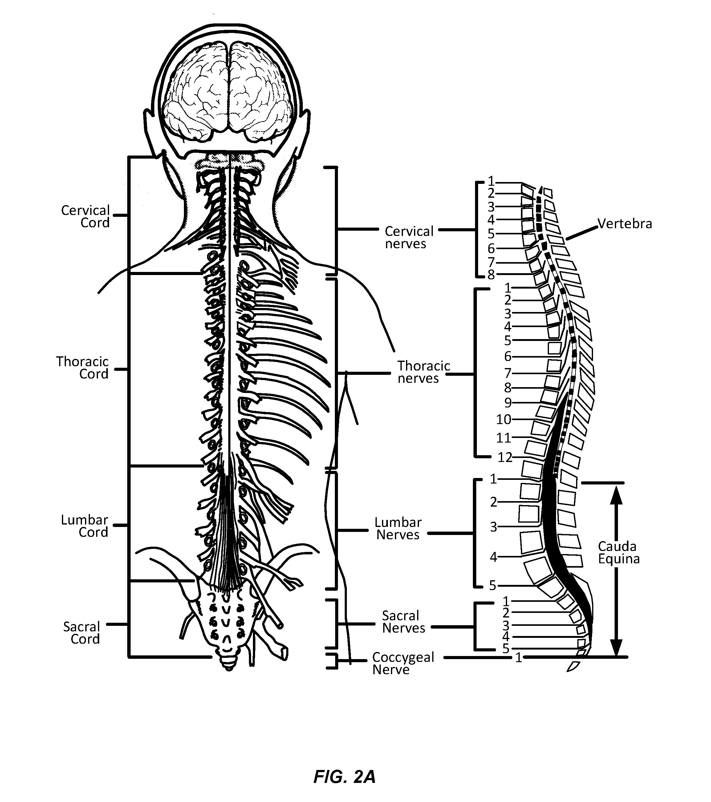 Electromyographic Lead Positioning and Stimulation Titration in a Nerve Stimulation System for Treatment of Overactive Bladder