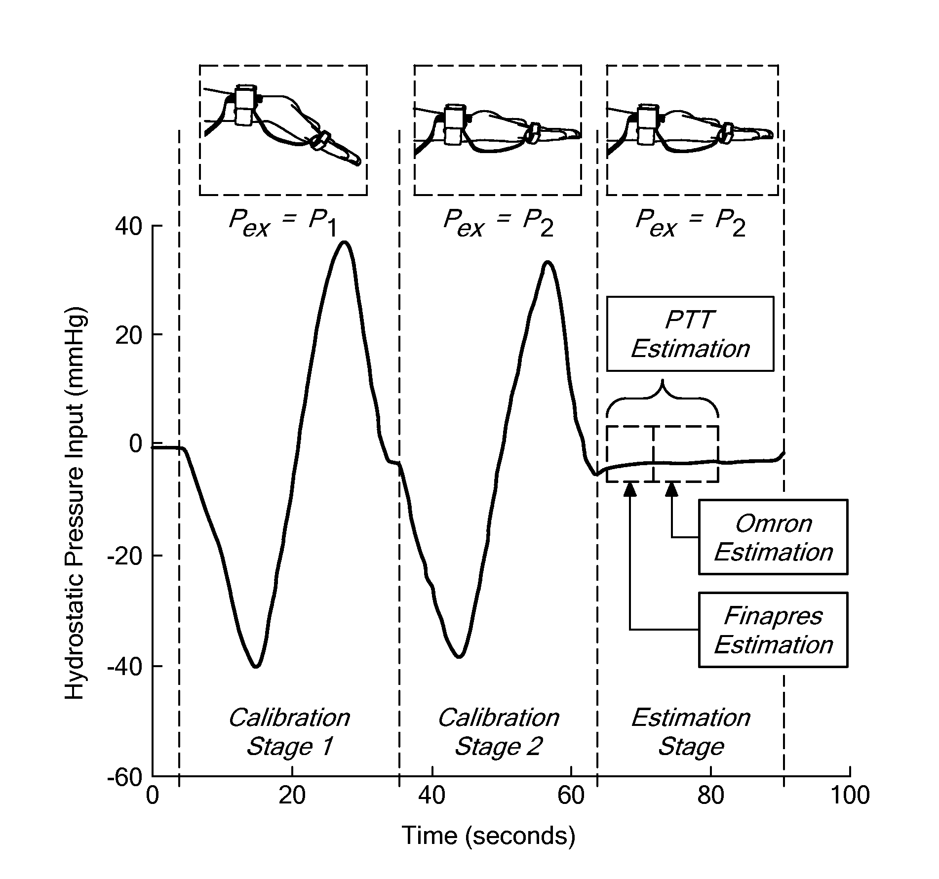 Calibration of pulse transit time measurements to arterial blood pressure using external arterial pressure applied along the pulse transit path