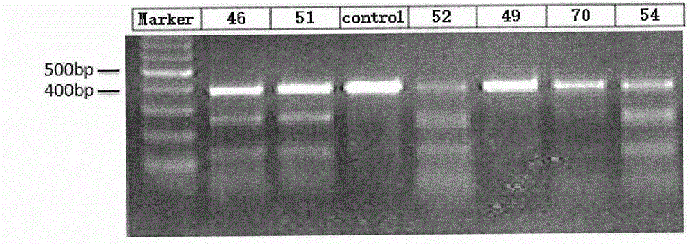 Method for specifically knocking out human PCSK9 gene by virtue of CRISPR-Cas9 and sgRNA for specifically targeting PCSK9 gene