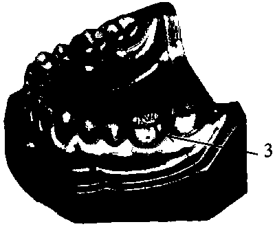 Tooth preparation body digital model design method