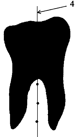 Tooth preparation body digital model design method