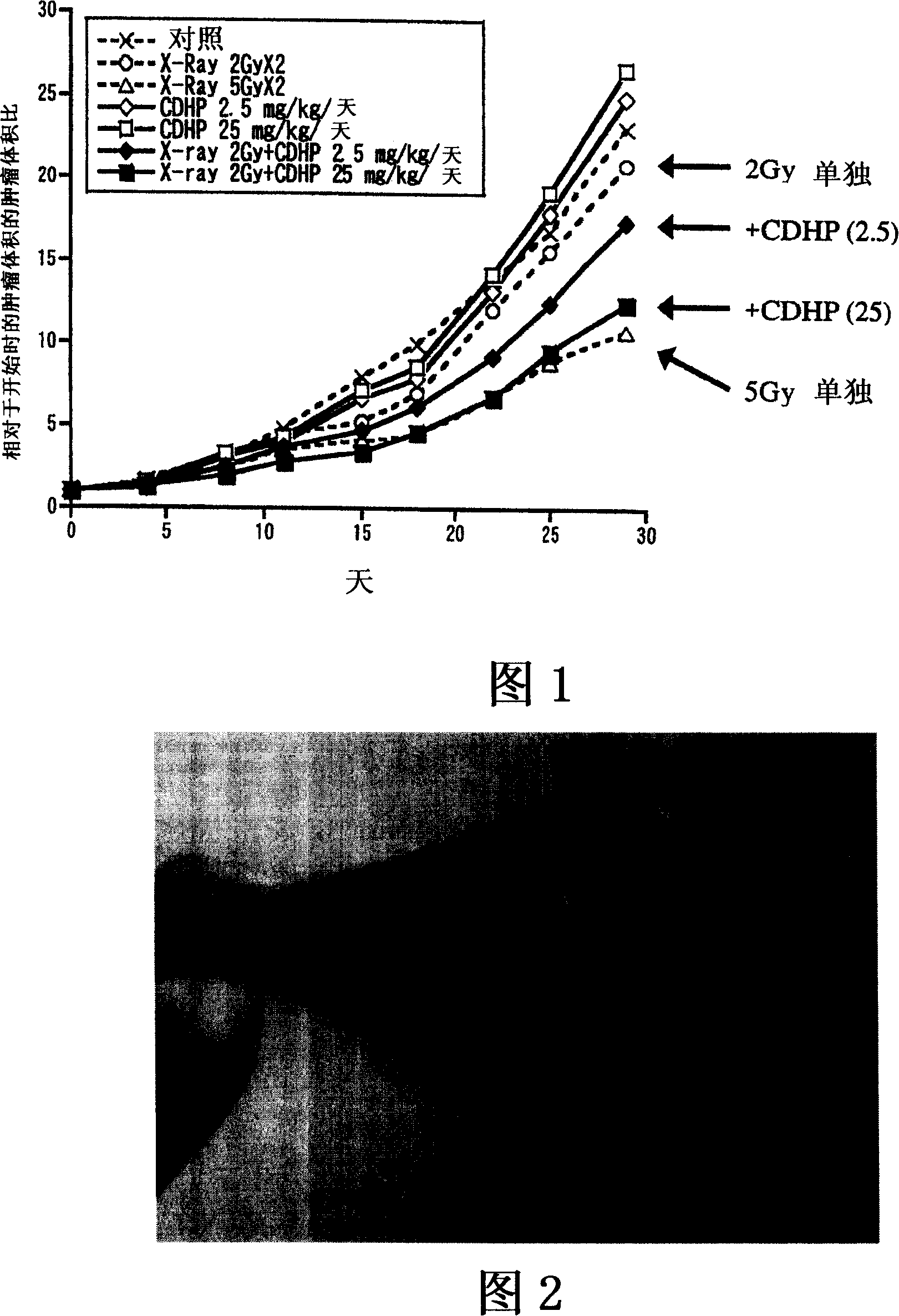 Potentiator for radiation therapy comprising pyridine derivative as active ingredient