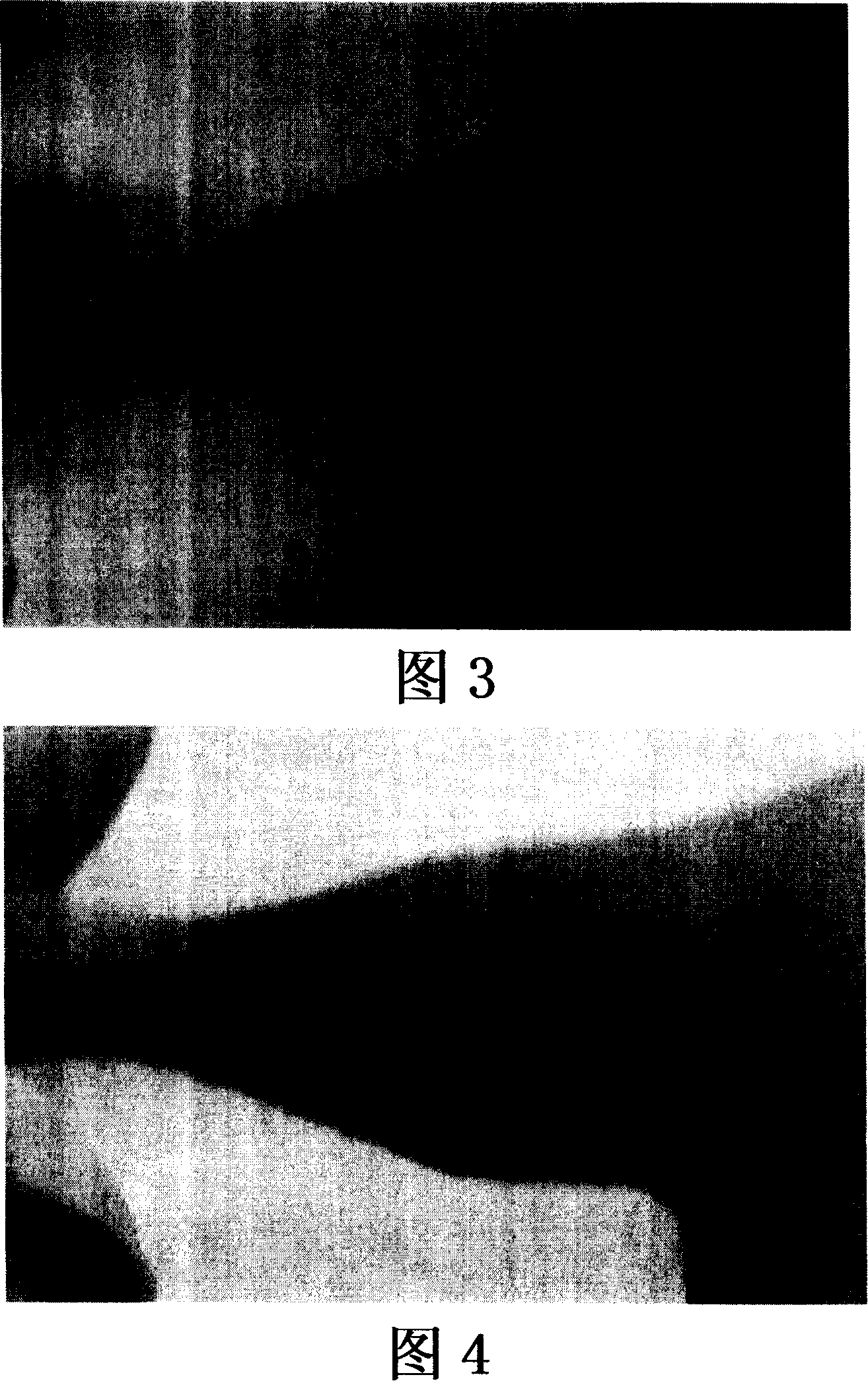 Potentiator for radiation therapy comprising pyridine derivative as active ingredient