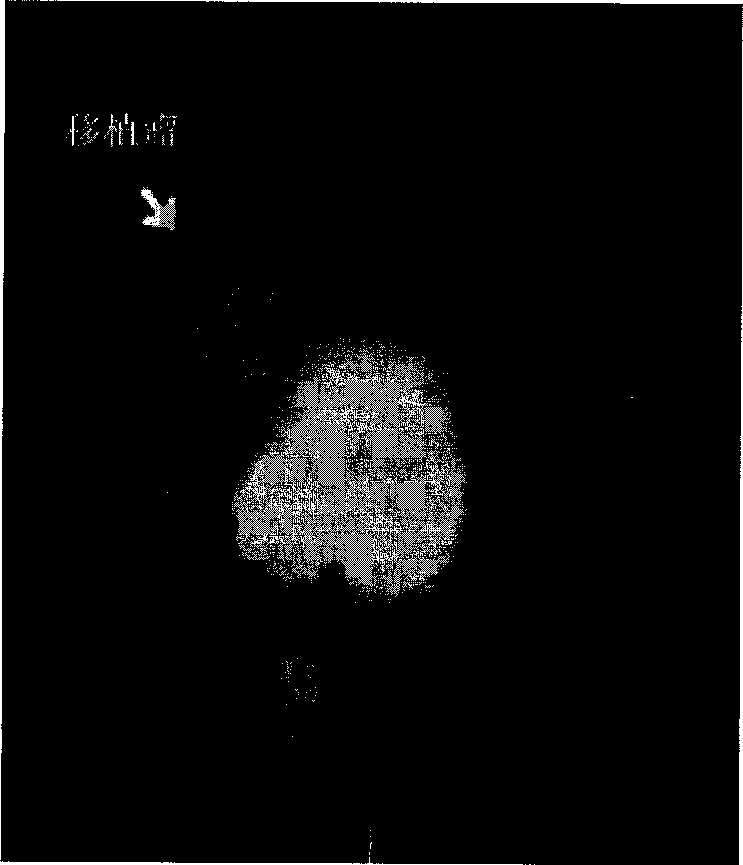 Protein marked by Tc-99 capable of specifically combined with GnRH-receptor expressed cancer cell