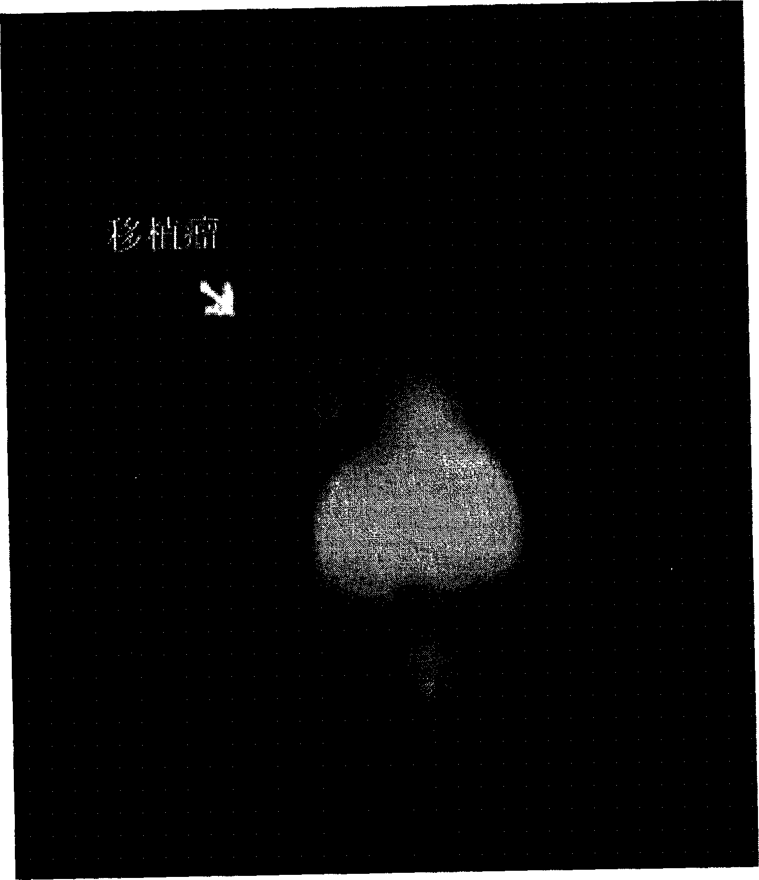 Protein marked by Tc-99 capable of specifically combined with GnRH-receptor expressed cancer cell