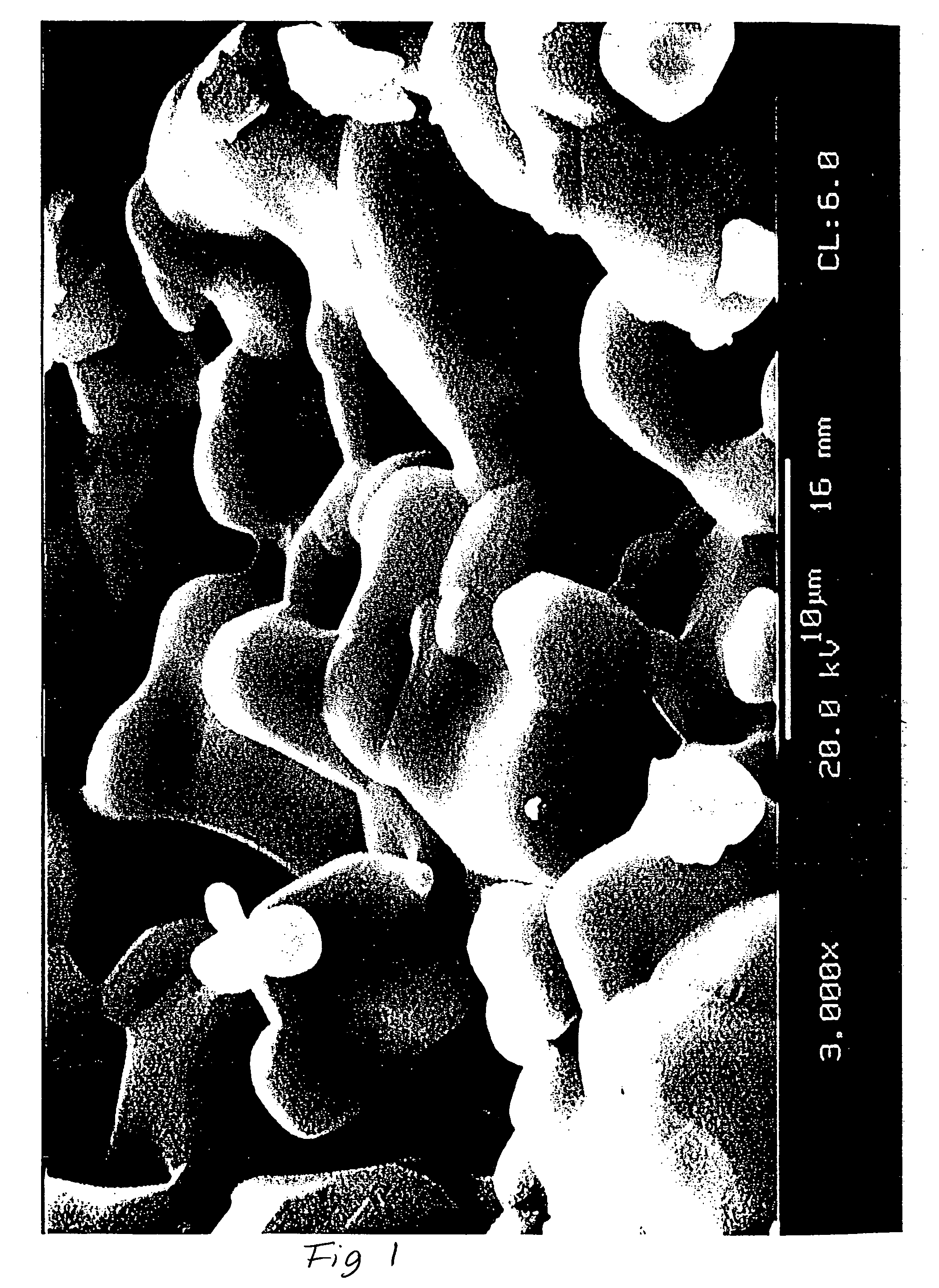 Resorbable bone replacement and bone formation material