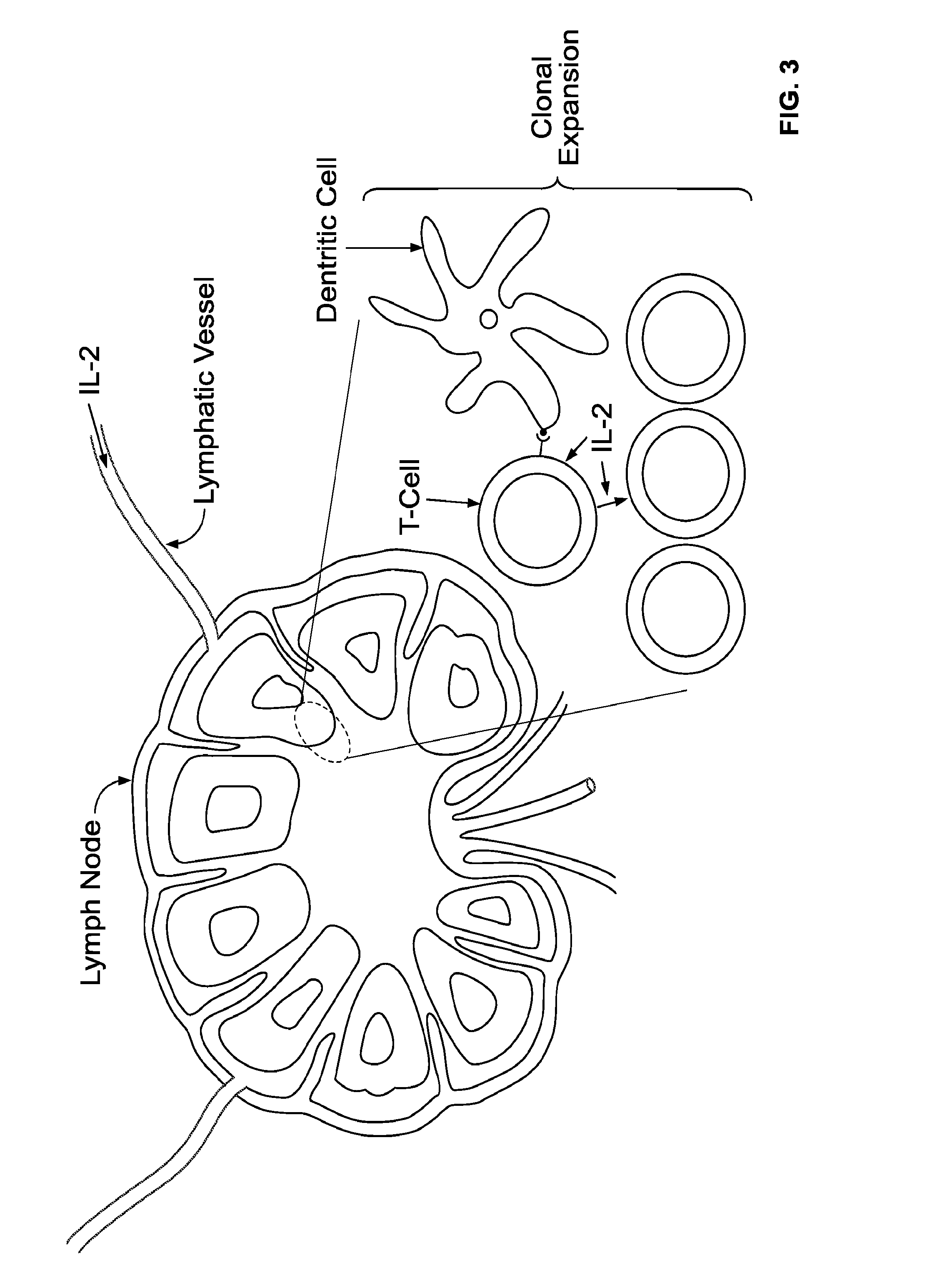 Neoadjuvant treatment of cancer with proleukin