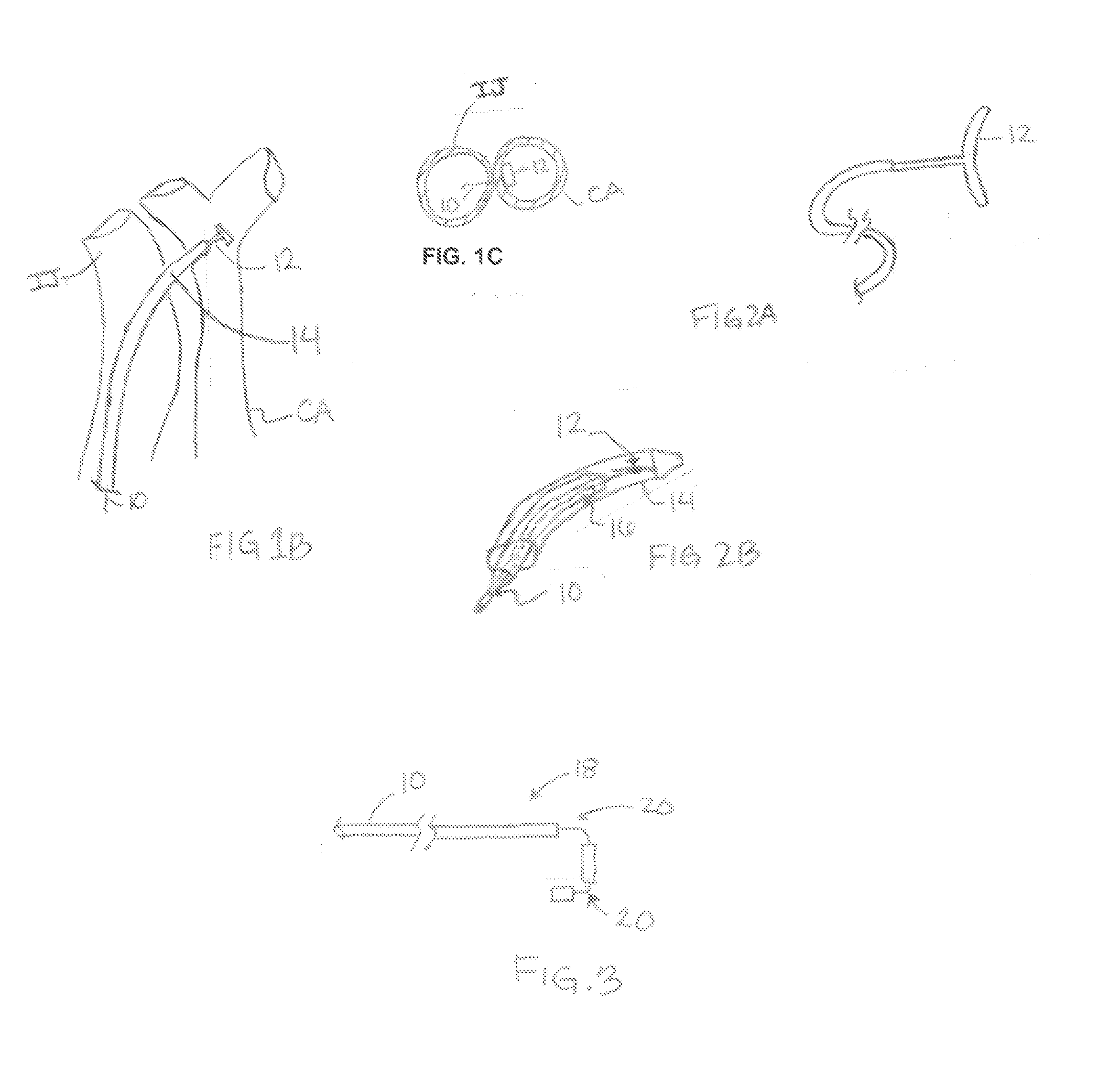 Intravascular system and method for blood pressure control