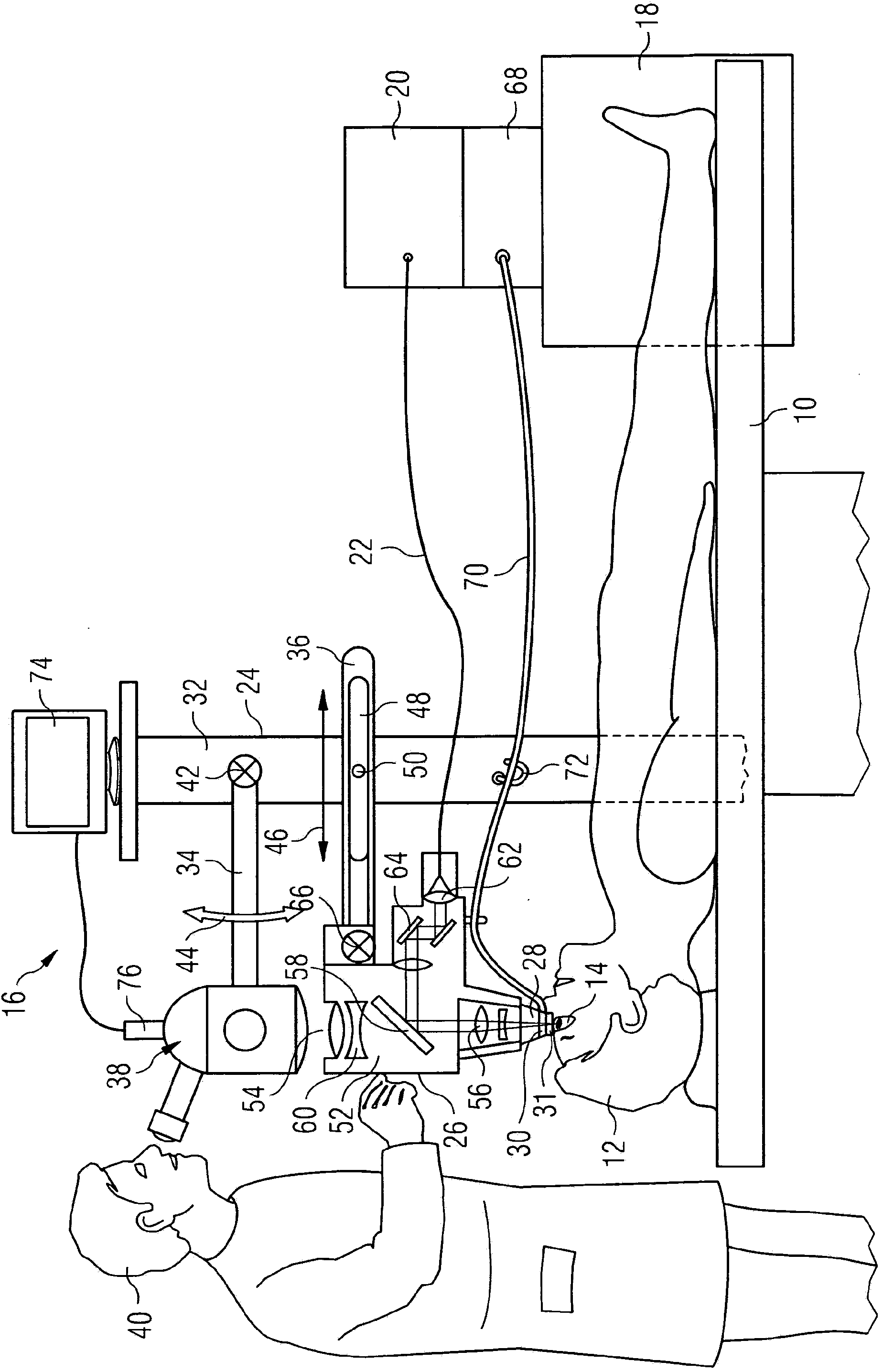 Apparatus and method for eye surgery