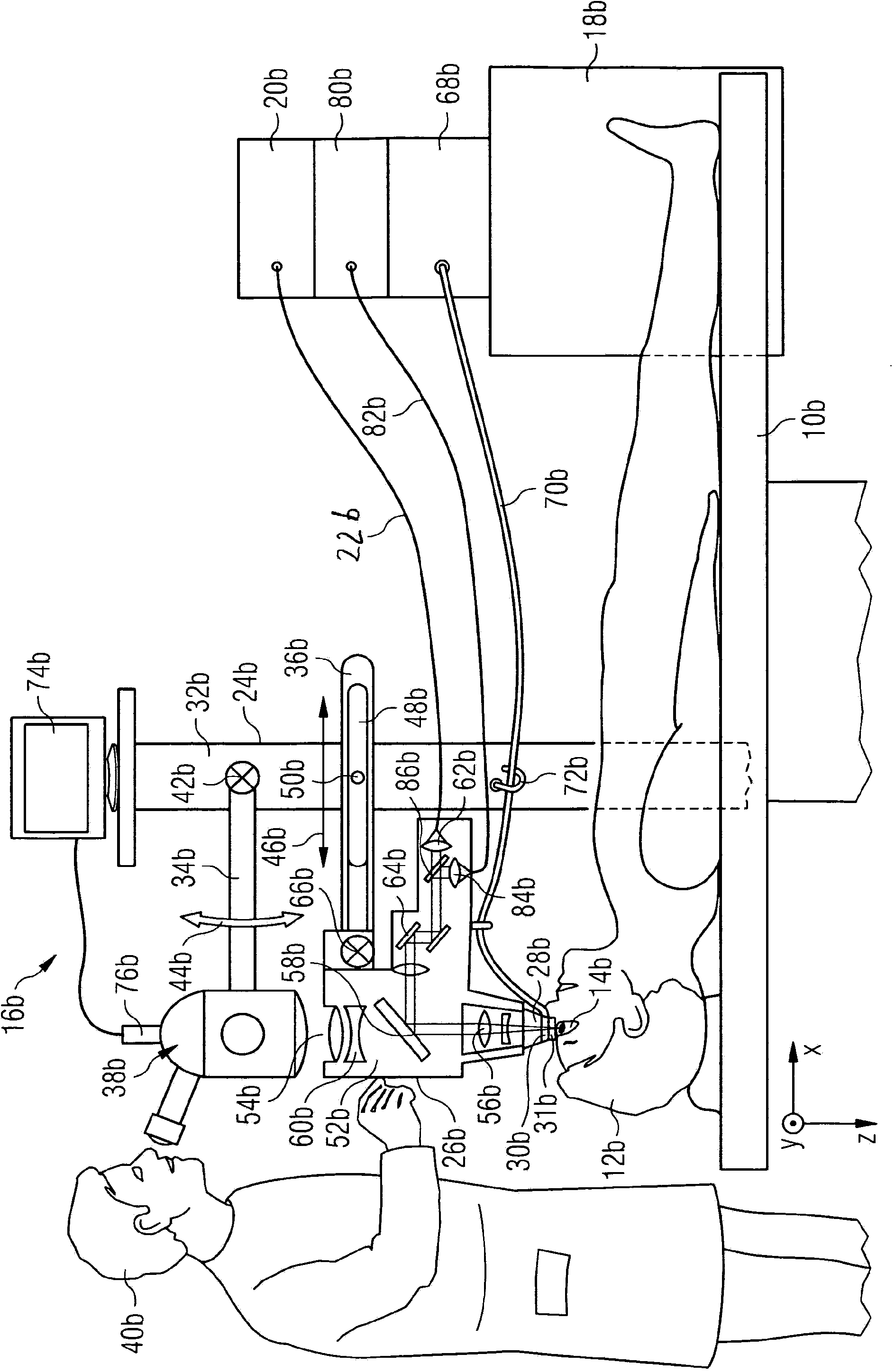 Apparatus and method for eye surgery