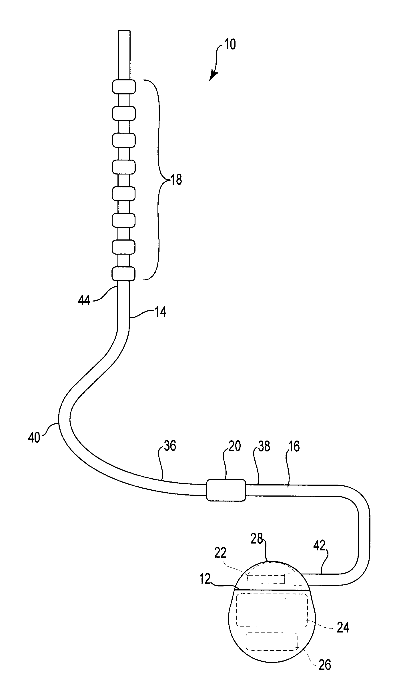 Epidural needle for spinal cord stimulation