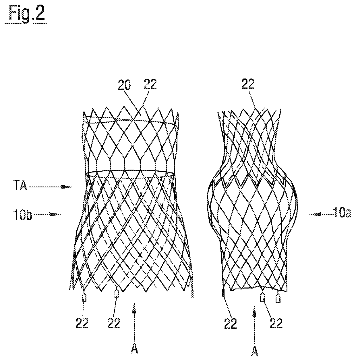 Self-expandable stent and set of stents