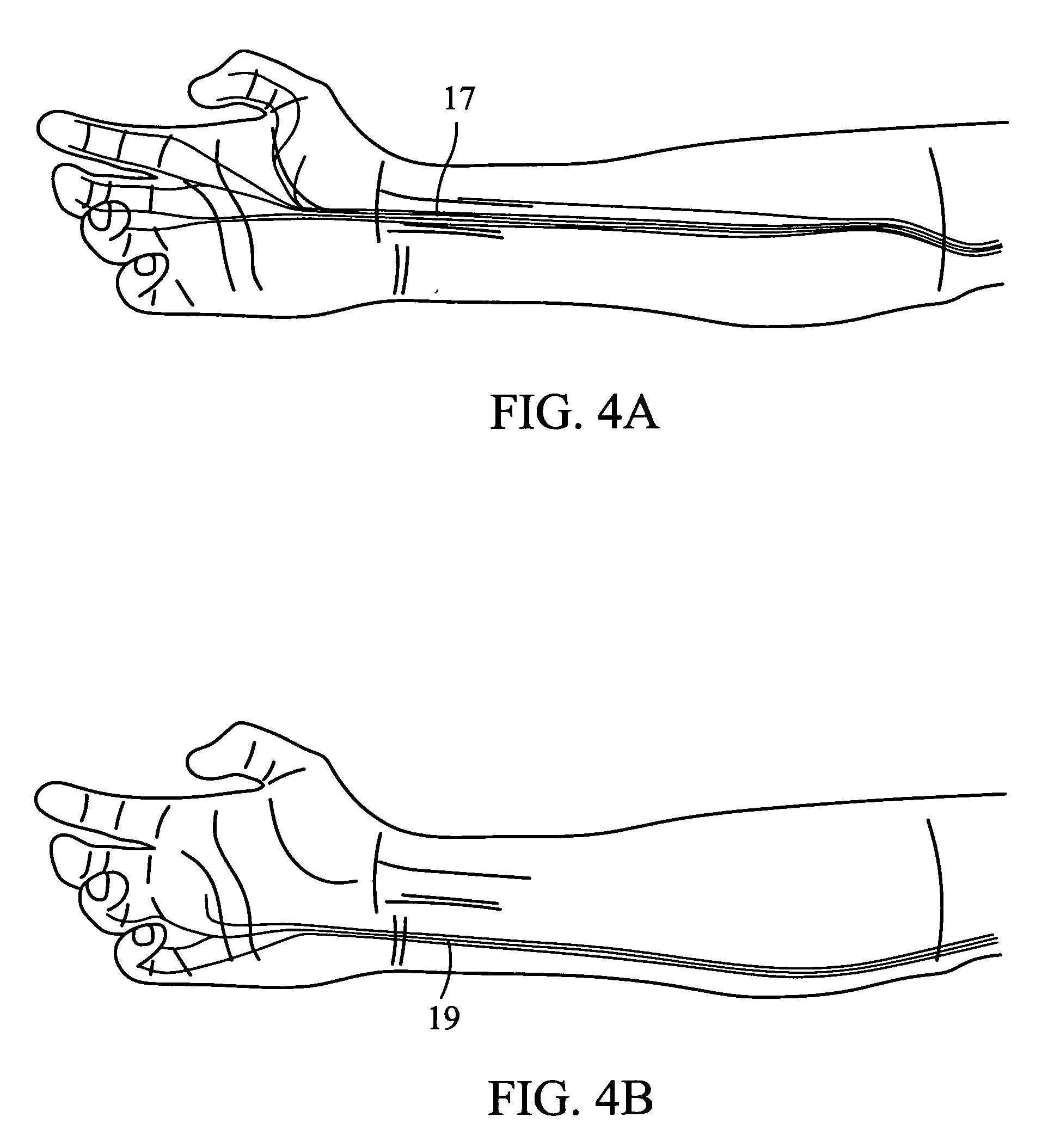 Energy diffusing glove insert