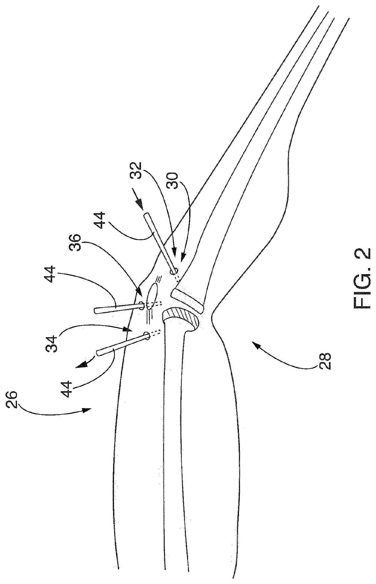 Systems and methods for reducing contaminants in a portion of a patient