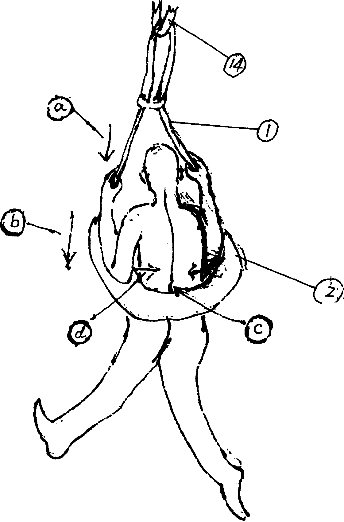 Vertical lumbar vertebra tractor