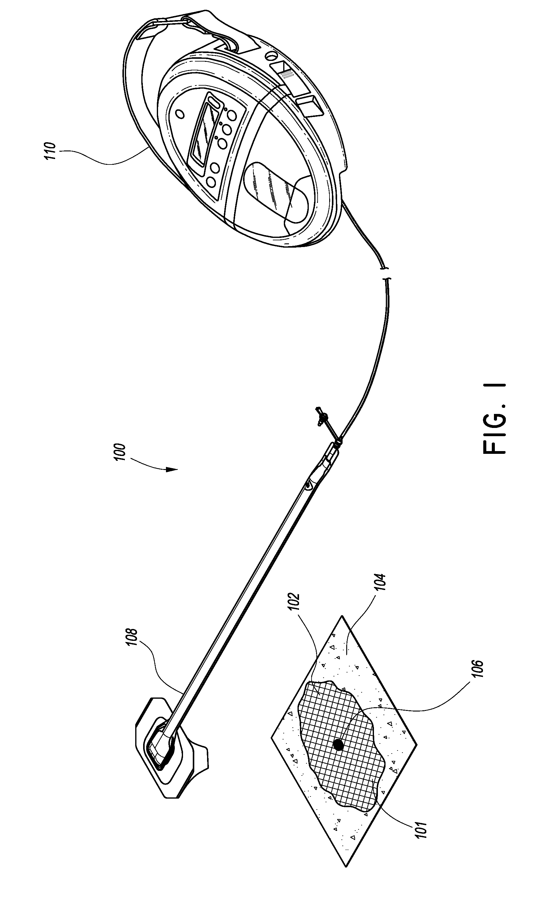 Negative pressure wound closure device