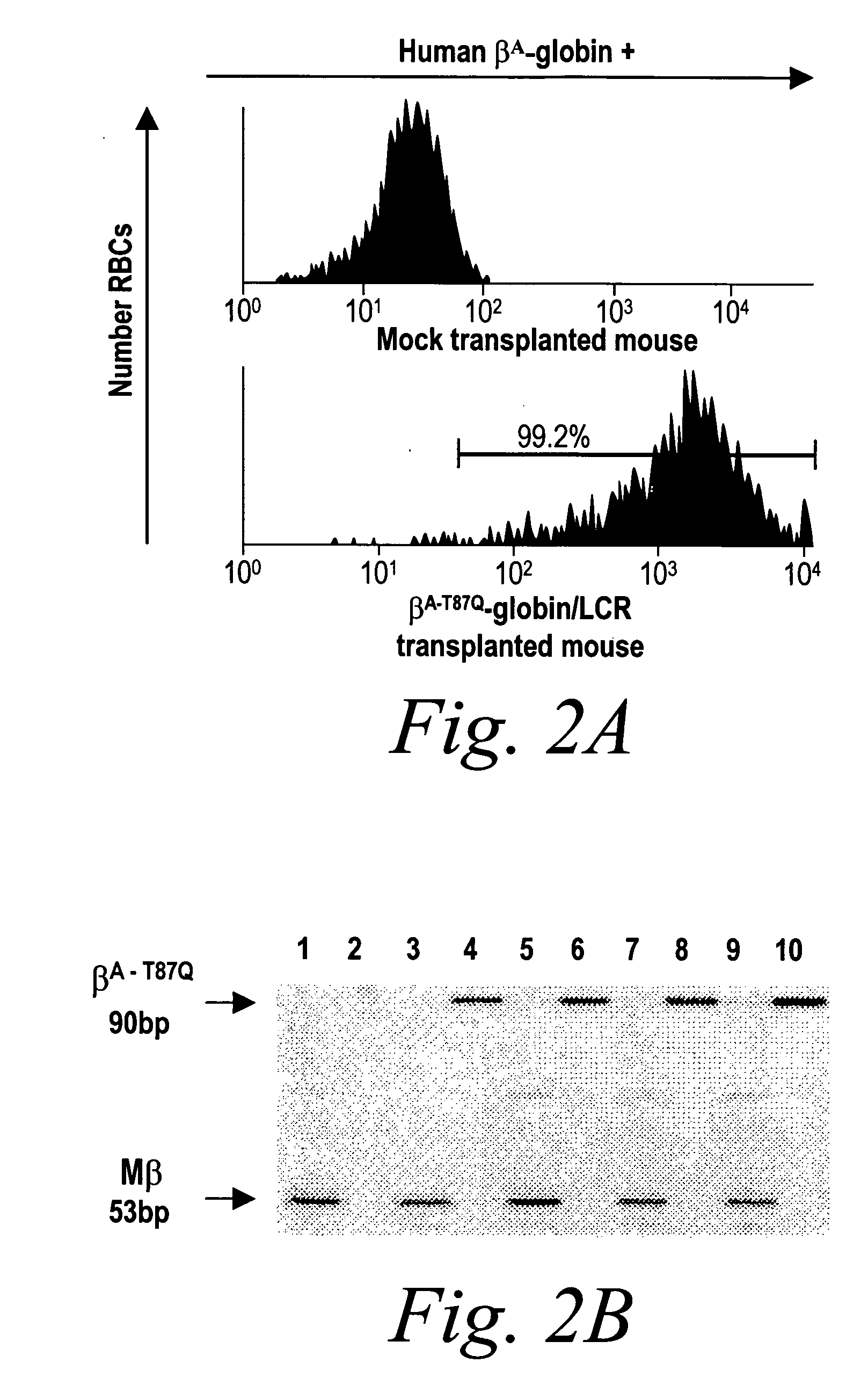 Therapeutic retroviral vectors for gene therapy