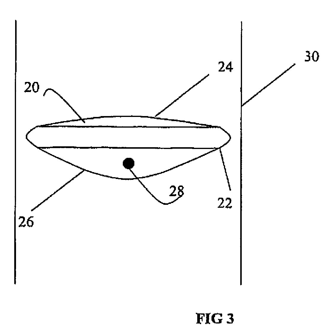 Diffusion barrier in a delivery apparatus for pressurized medical liquids