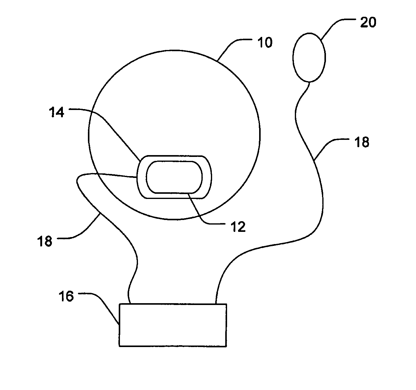 Ocular administration of immunosuppressive agents