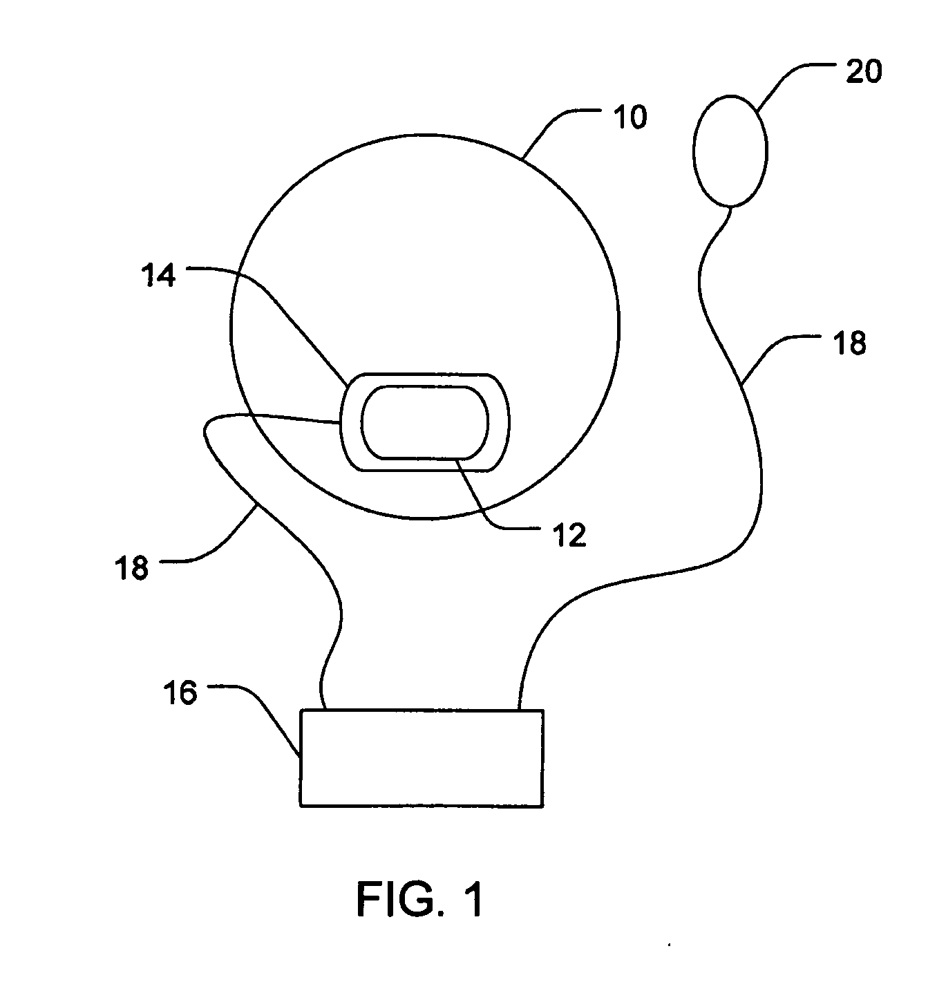 Ocular administration of immunosuppressive agents