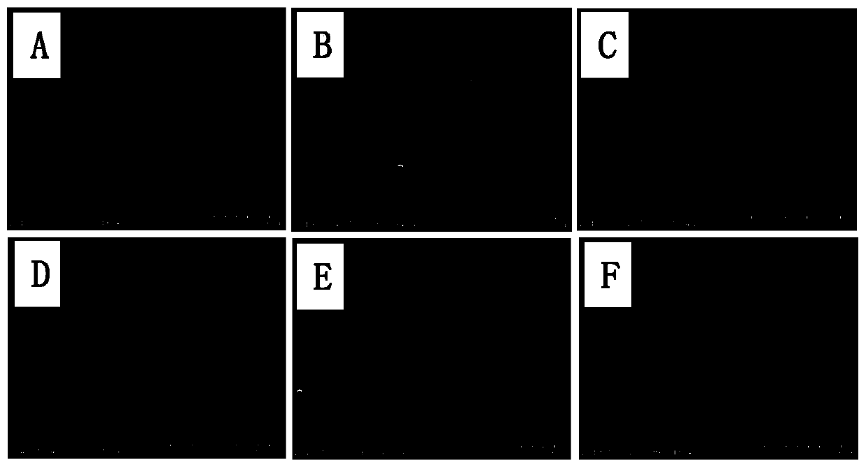 BFGF-loaded guided tissue regeneration membrane with core-shell structure and preparation method of bFGF-loaded guided tissue regeneration membrane